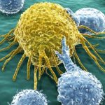 Scientists manage to cure bladder cancer with the common cold virus