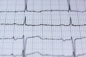 ELECTROCARDIOGRAM FOR COVID PATIENTS