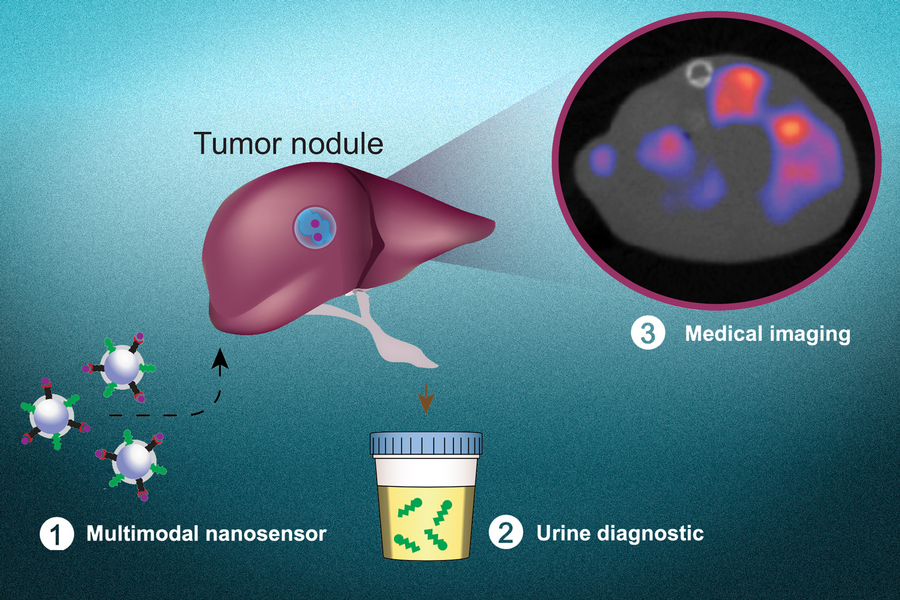 new non-invasive technique to detect Cancer