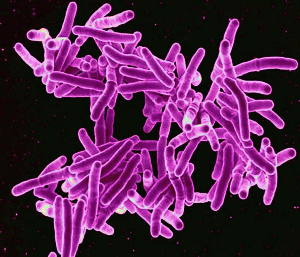 BACTERIA DE LA TUBERCULOSIS